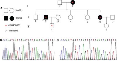 Prevalence and clinical characteristics of T2DM patients with OTUD3 gene rs78466831 SNP at a single academic center in China